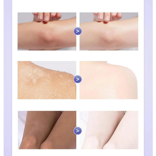 Omenfee Cold White Skin All Over Body Cream
